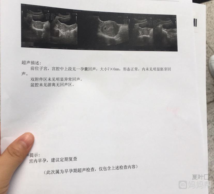 怀孕多少周有胚芽