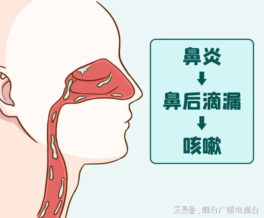 鼻后滴漏咳嗽特点