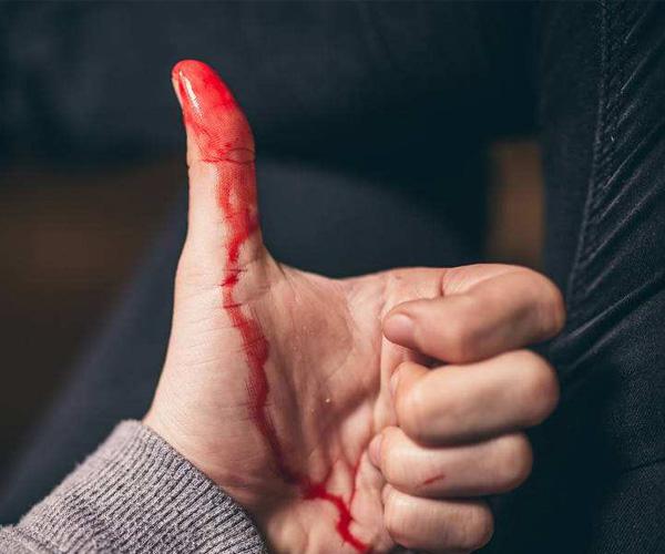 女人梦见自己流血