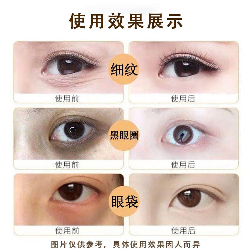 眼霜 黑眼圈