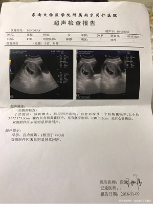 怀孕七周可以做人流吗