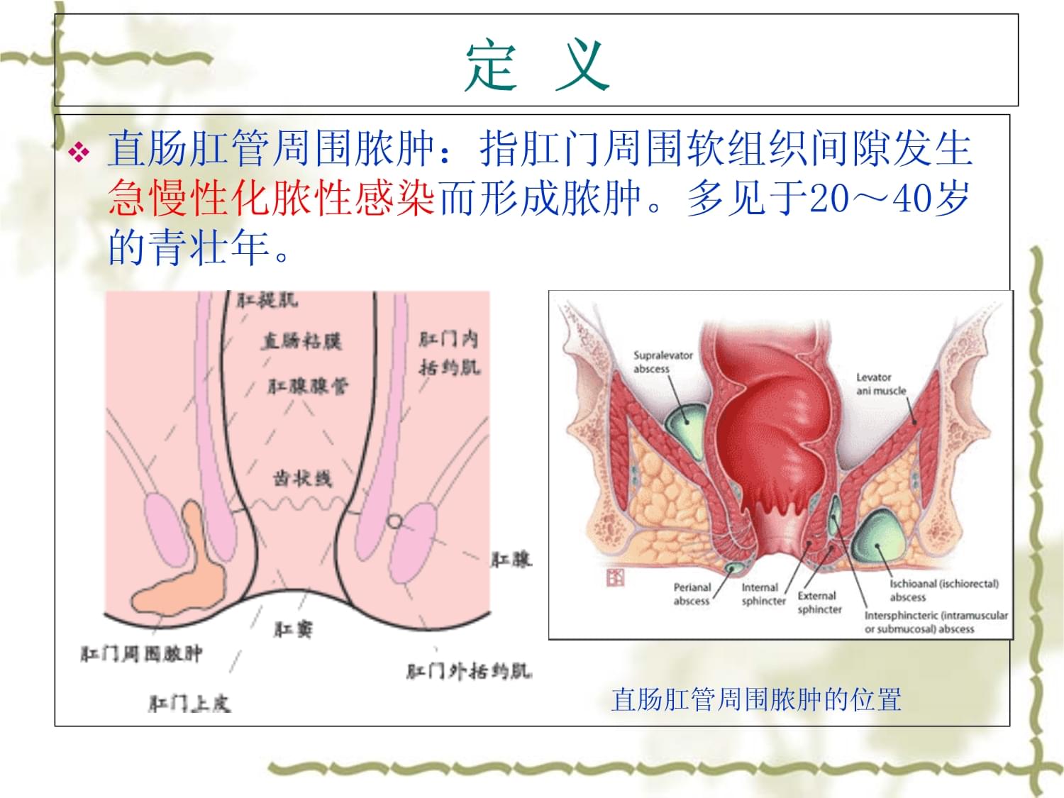 新生儿肛周脓肿图片