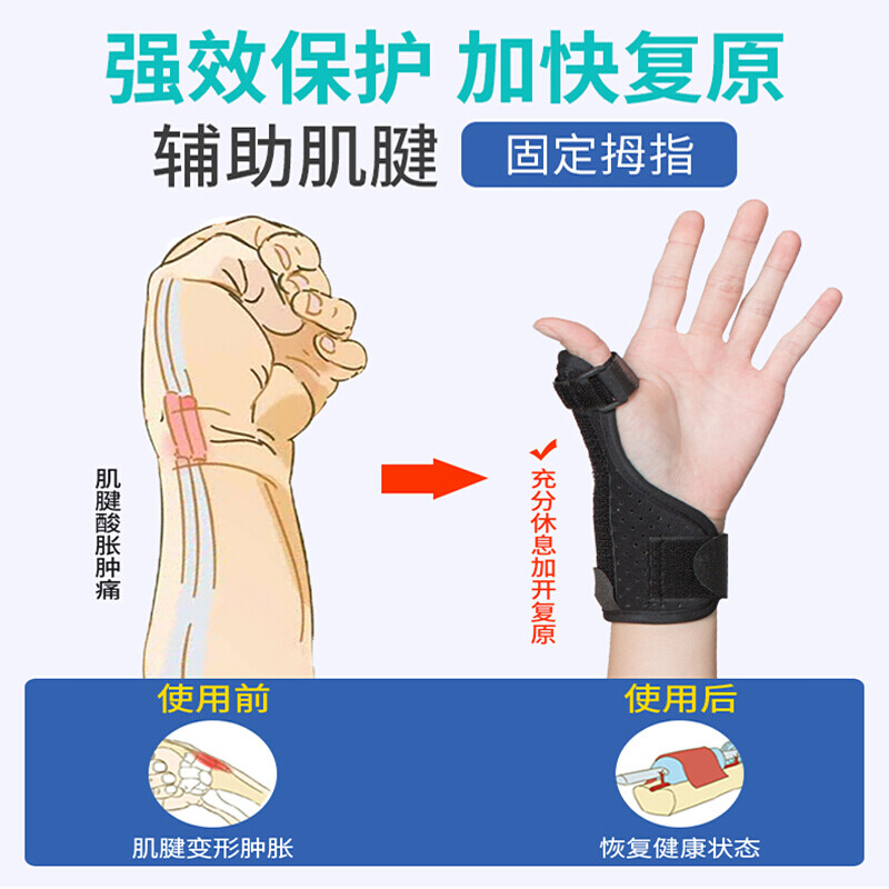 手指肌腱断裂算轻伤吗