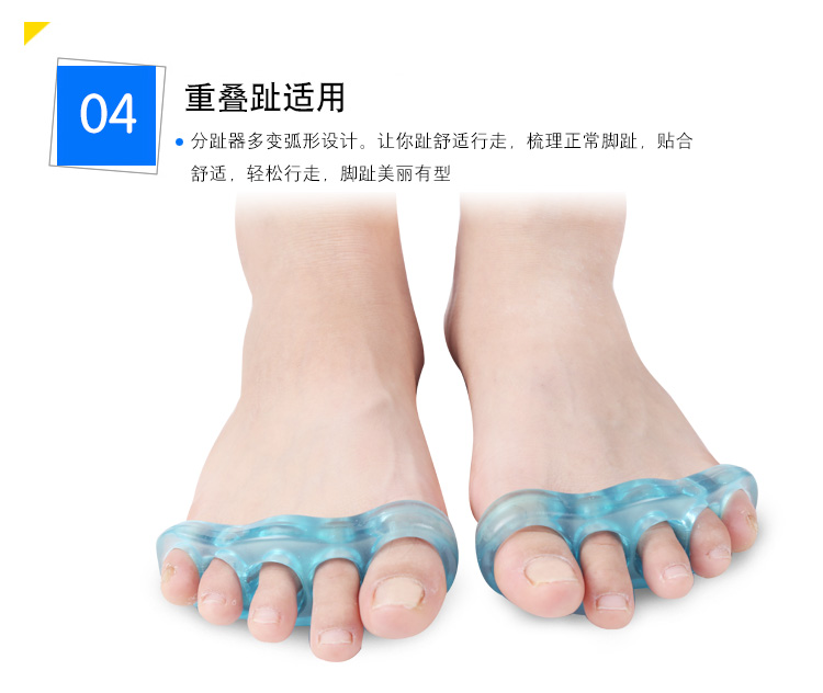 宝宝脚趾重叠图片