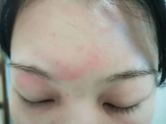 额头右边疼是怎么回事