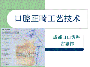 口腔正畸隐形矫正ppt