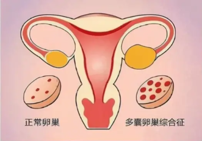 卵巢卵泡有多少个