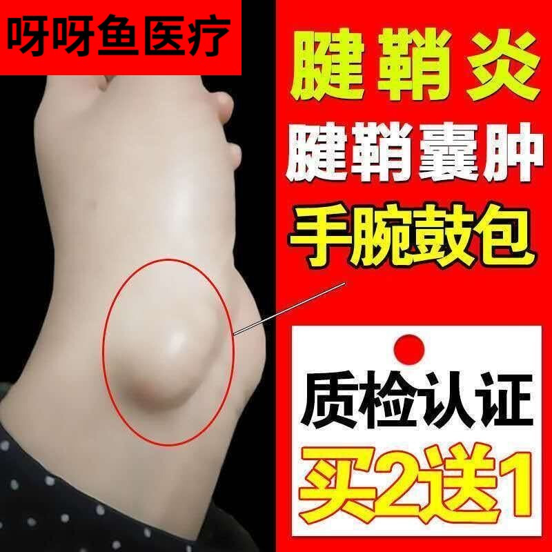 手指关节腱鞘囊肿怎么治疗