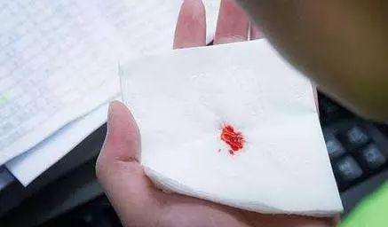 咳嗽带血丝怎么回事