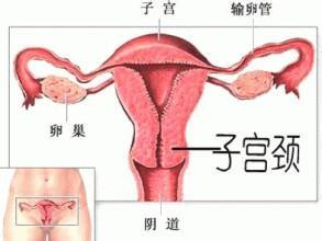 宫颈炎影响怀孕吗