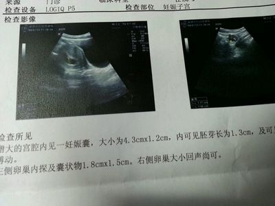 怀孕35天怀男孩症状