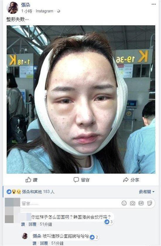 过敏脸肿了是怎么回事