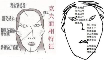 人中歪斜的面相