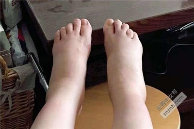 孕妇脚肿是什么原因