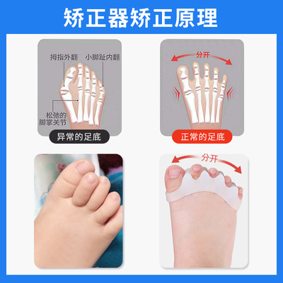 宝宝脚趾重叠图片