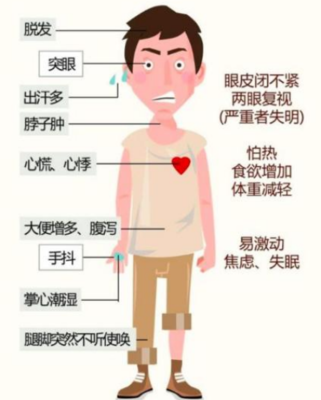 得了甲亢怎么治疗