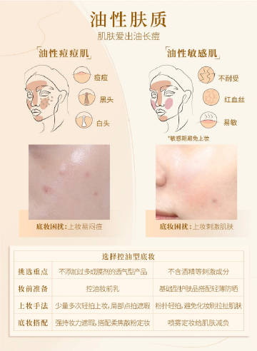 敏感肌痘痘肌