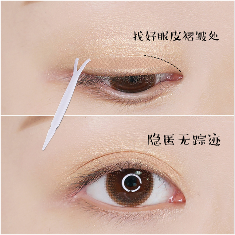 能贴双眼皮贴睡觉吗