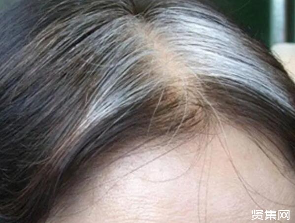 为什么会长白头发?有什么方法不长白头发?-贤集网