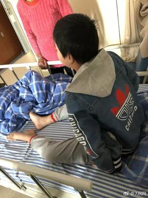 致人鼻梁骨折算轻伤吗