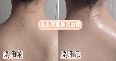 男生多大不长痘痘