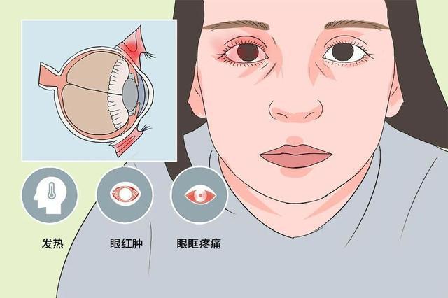 左边偏气疼是怎么回事