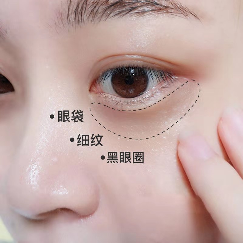 眼霜去皱纹哪款好