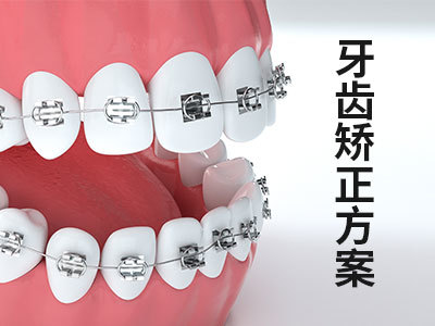 矫正牙齿隐形牙套价位